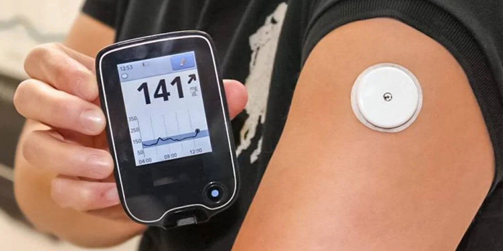 Continuous Glucose Monitoring (CGM) Continuous Glucose Monitoring (CGM)