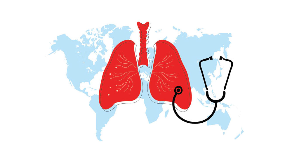 Tuberculosis TB Treatment Tuberculosis TB Treatment